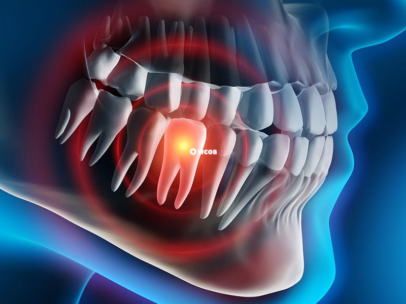拔牙后吃甲硝唑期间要保持口腔健康