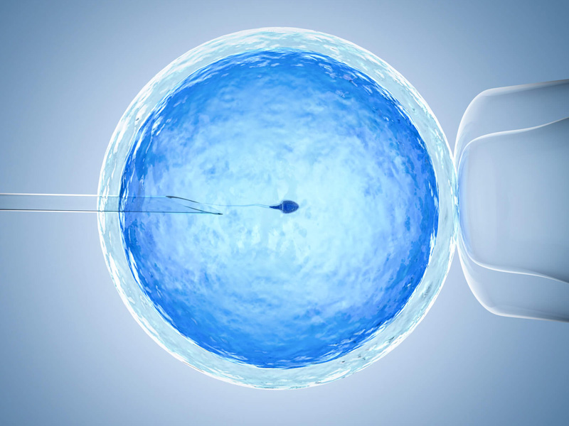 改善精卵质量可预防3pn胚胎